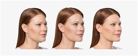 WEG MET DE ONDERKIN, over BELKYRA aka KYBELLA — wie.